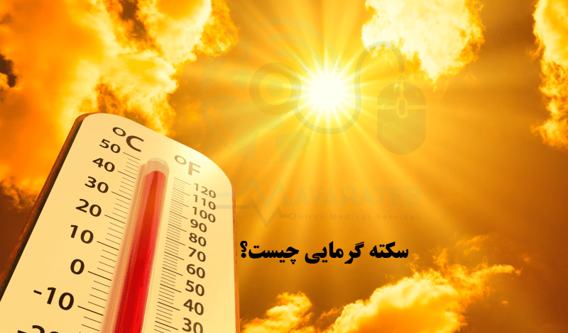 رفع سریع گرمازدگی 